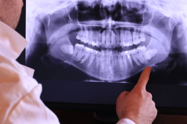 Best Emergency Tooth Extraction in Jonestown, TX