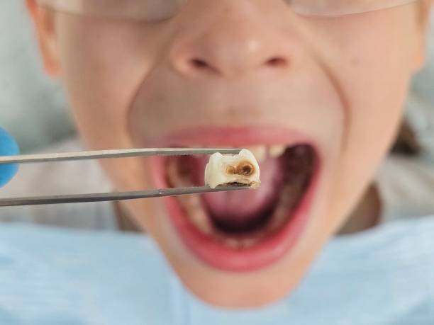 Best Same-Day Emergency Dental Services in Jonestown, TX